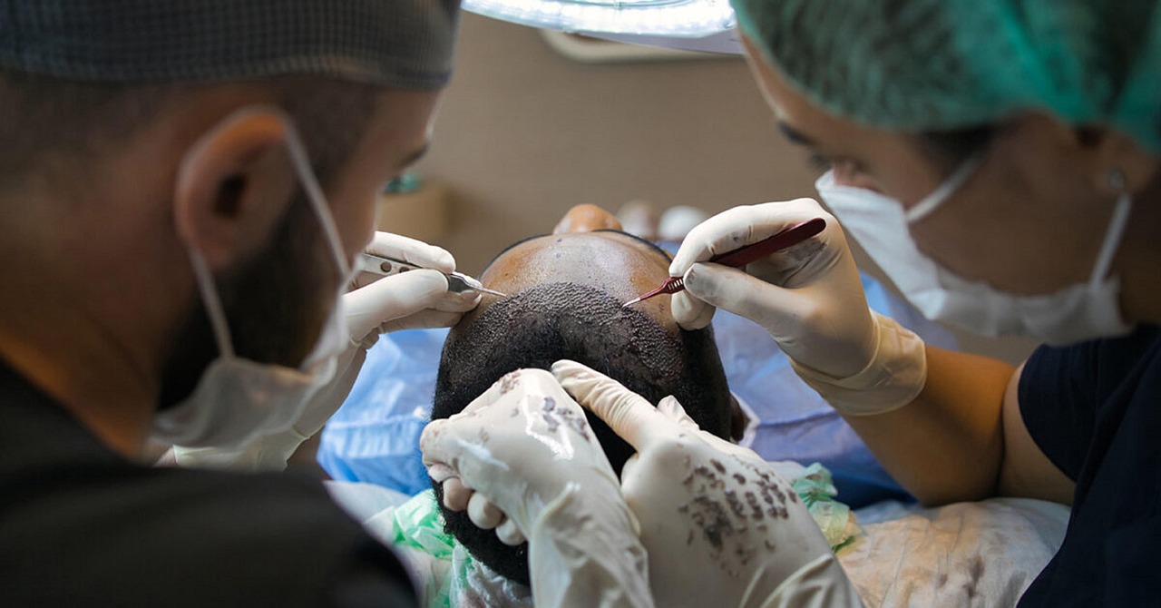Hair Transplant Travel Plan in Turkey