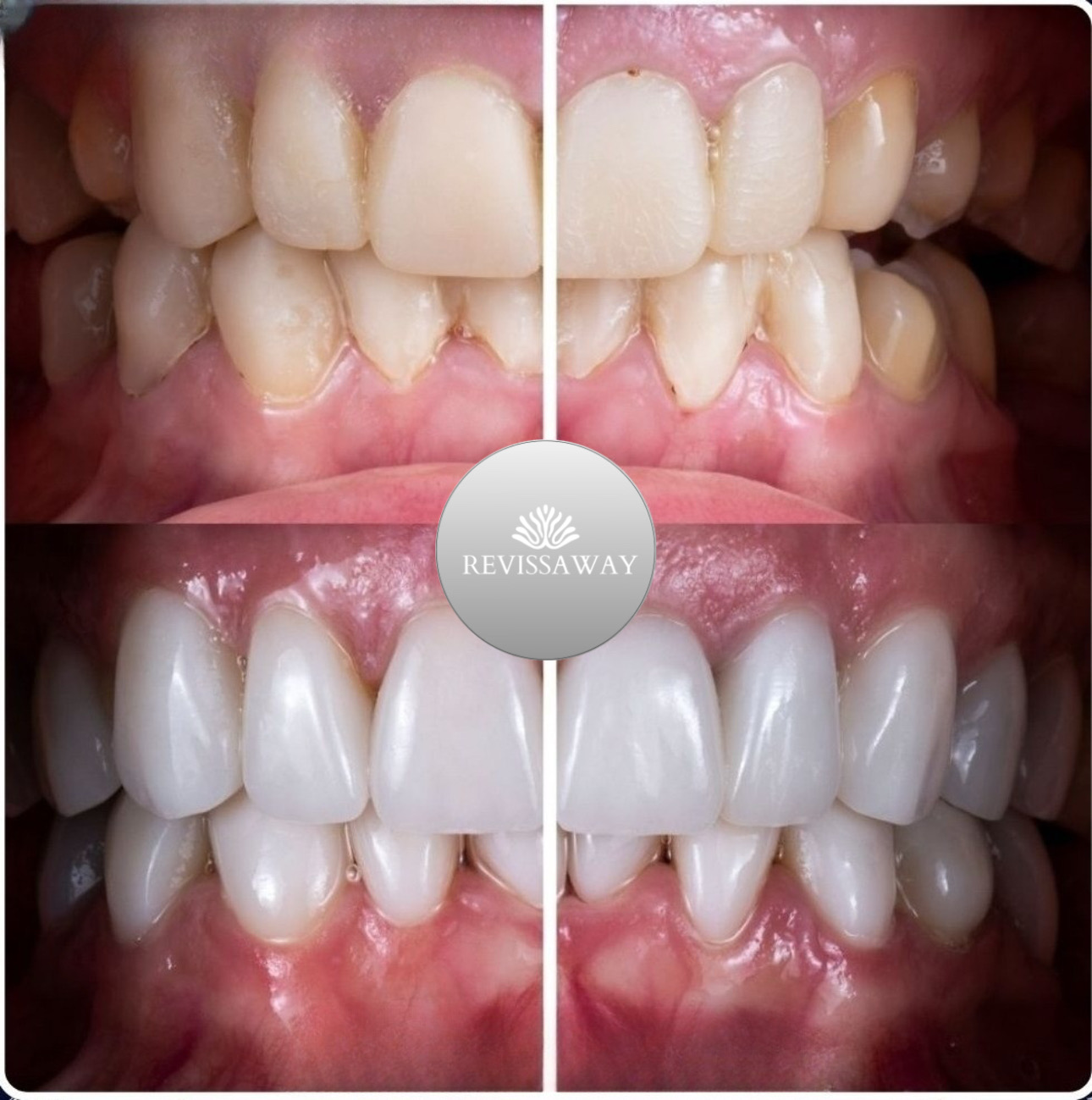 Smile Aesthetics Before & After 1