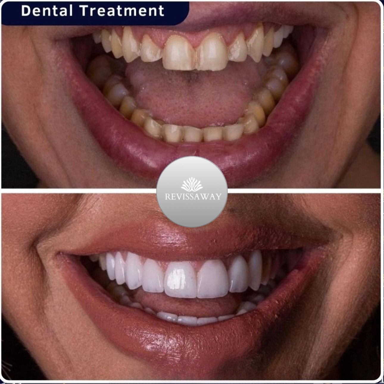 Smile Aesthetics Before & After 4